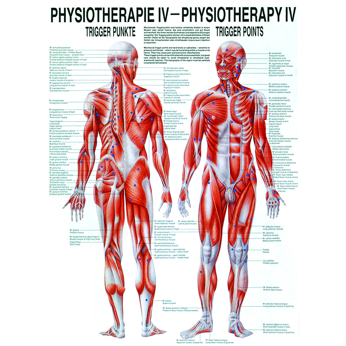 Anatomische Lehrtafel "Triggerpunkte 34 x 24"